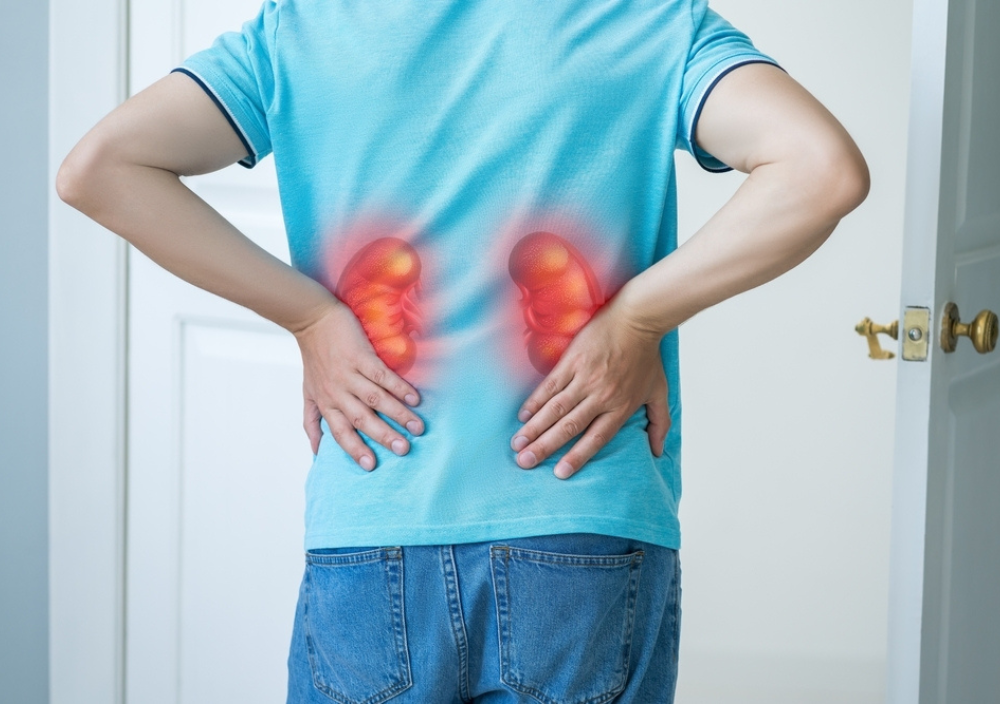 Λιθίαση νεφρού